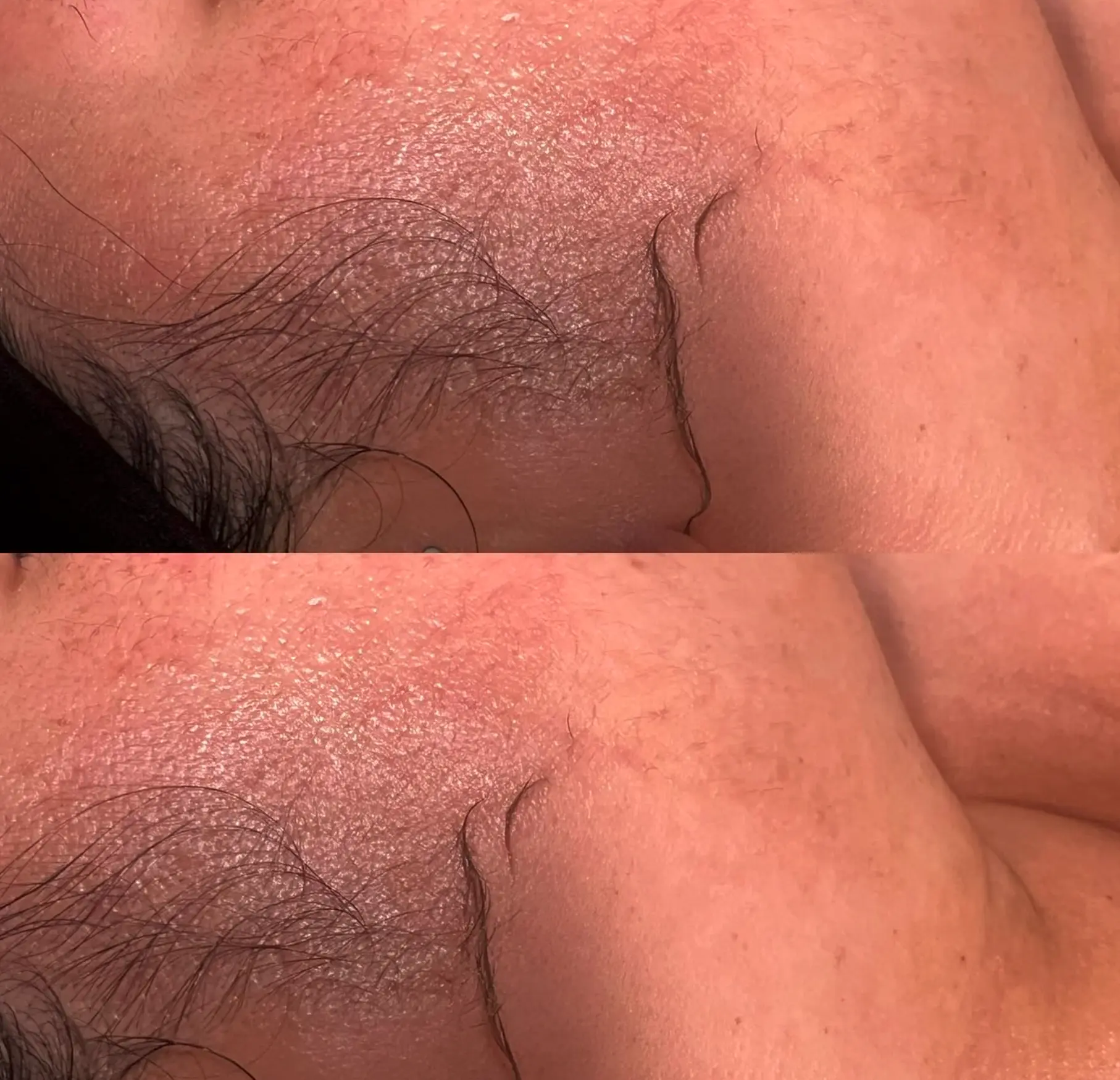 Queen City Project | Do and don'ts of dermaplaning? Do Moisturise Right After
