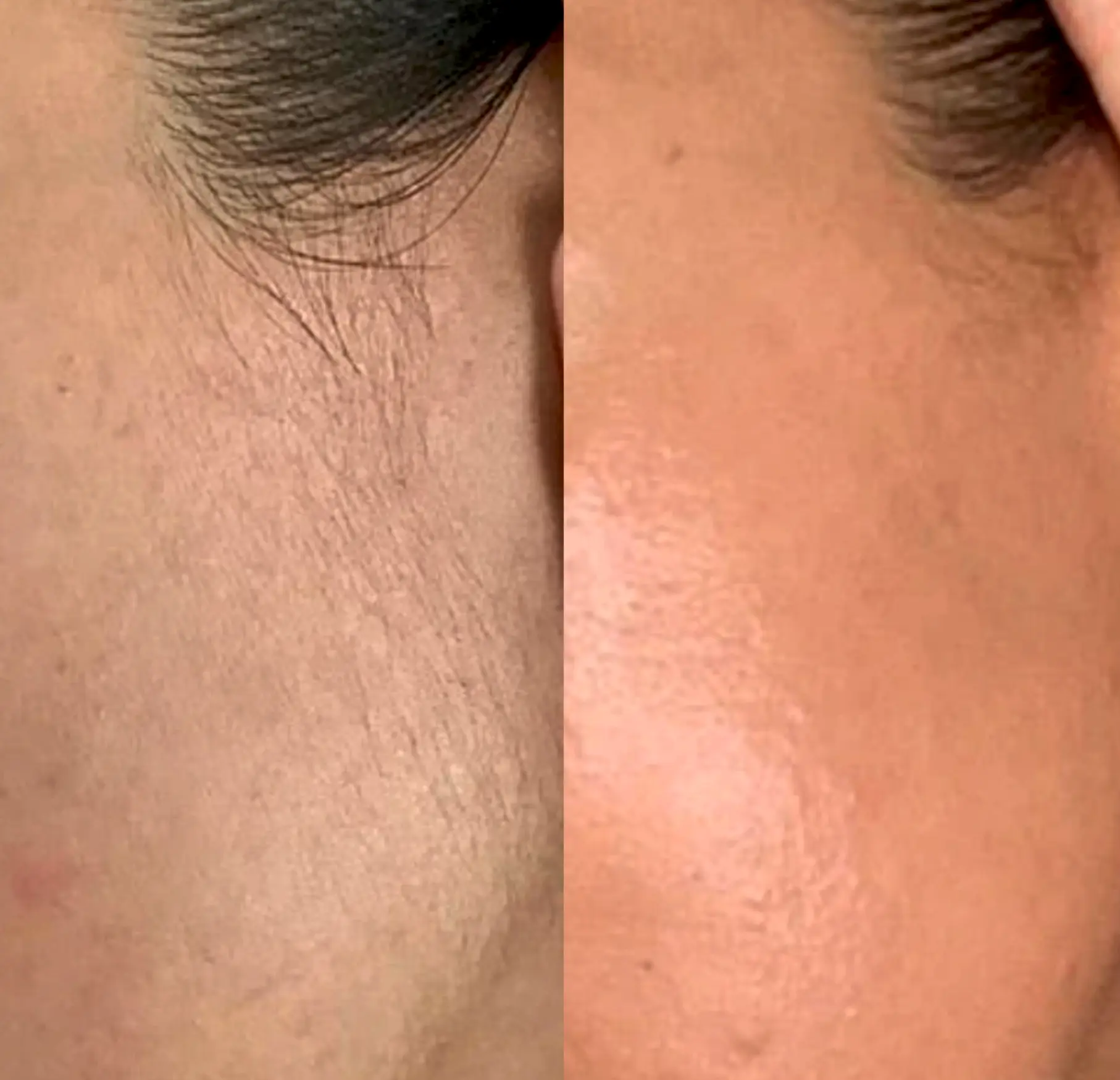 Queen City Project | Do and don'ts of dermaplaning? Do Prep Your Skin Properly
