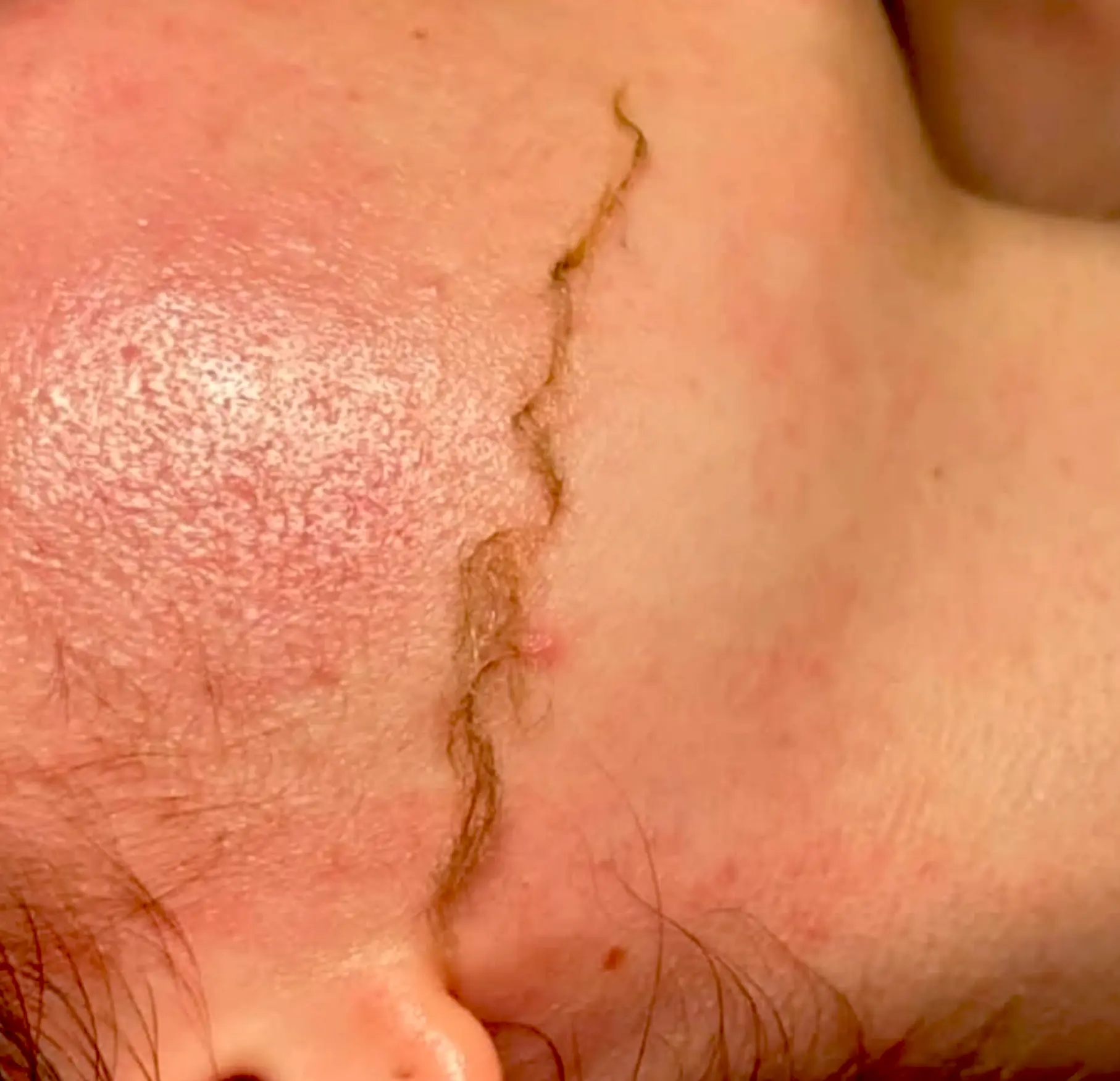 Queen City Project | Do and don'ts of dermaplaning? Do Stick to a Schedule