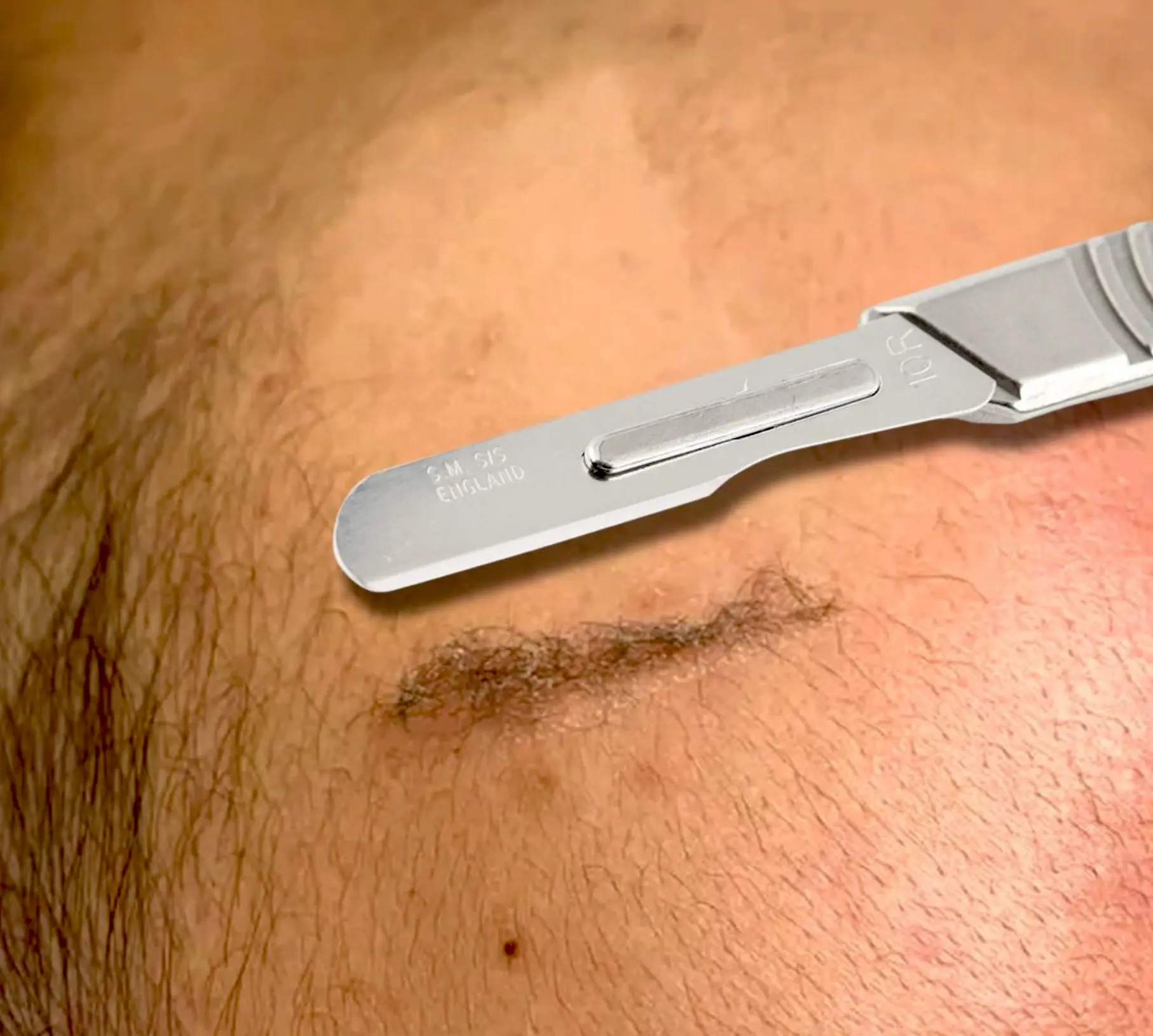 Queen City Project | Do and don'ts of dermaplaning? Hair Grows Back Thicker