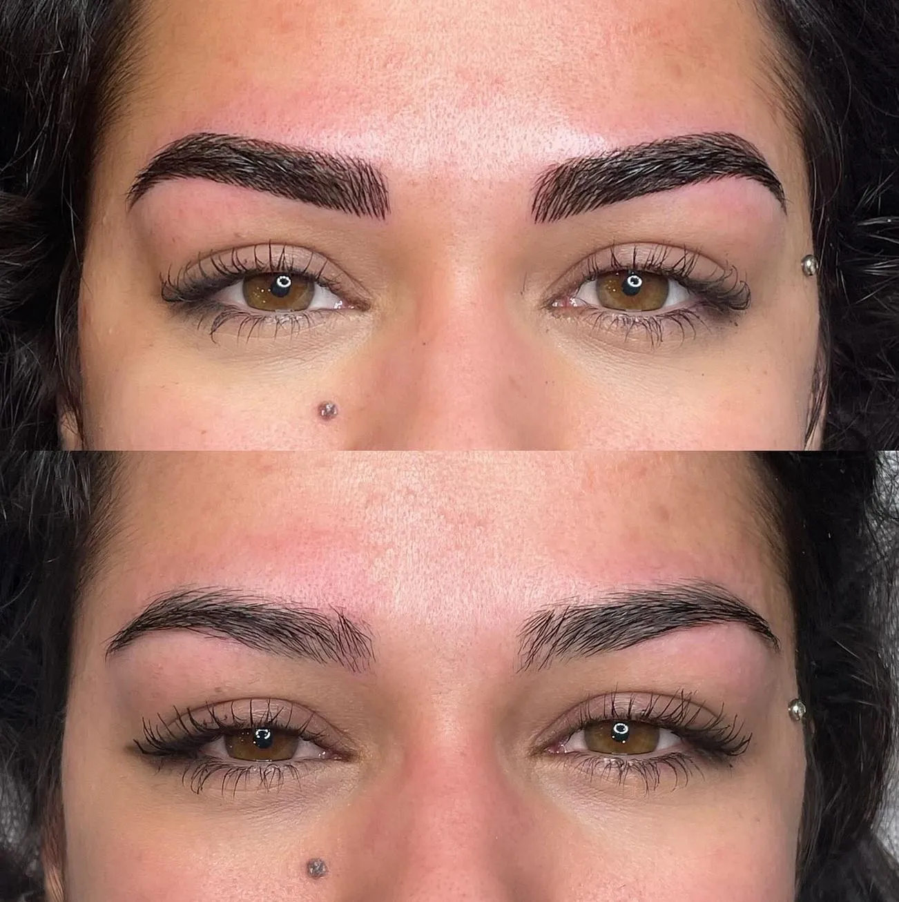 Queen City Project | How Do You Remove Fresh Microblading? Healing Timeline After Removal