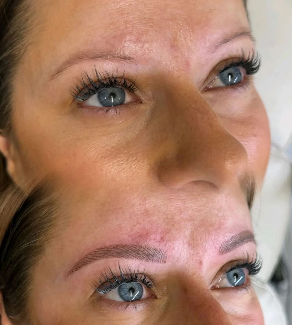 Queen City Project | How Do You Remove Fresh Microblading? Real Client Case, Faded Too Dark Brow Job