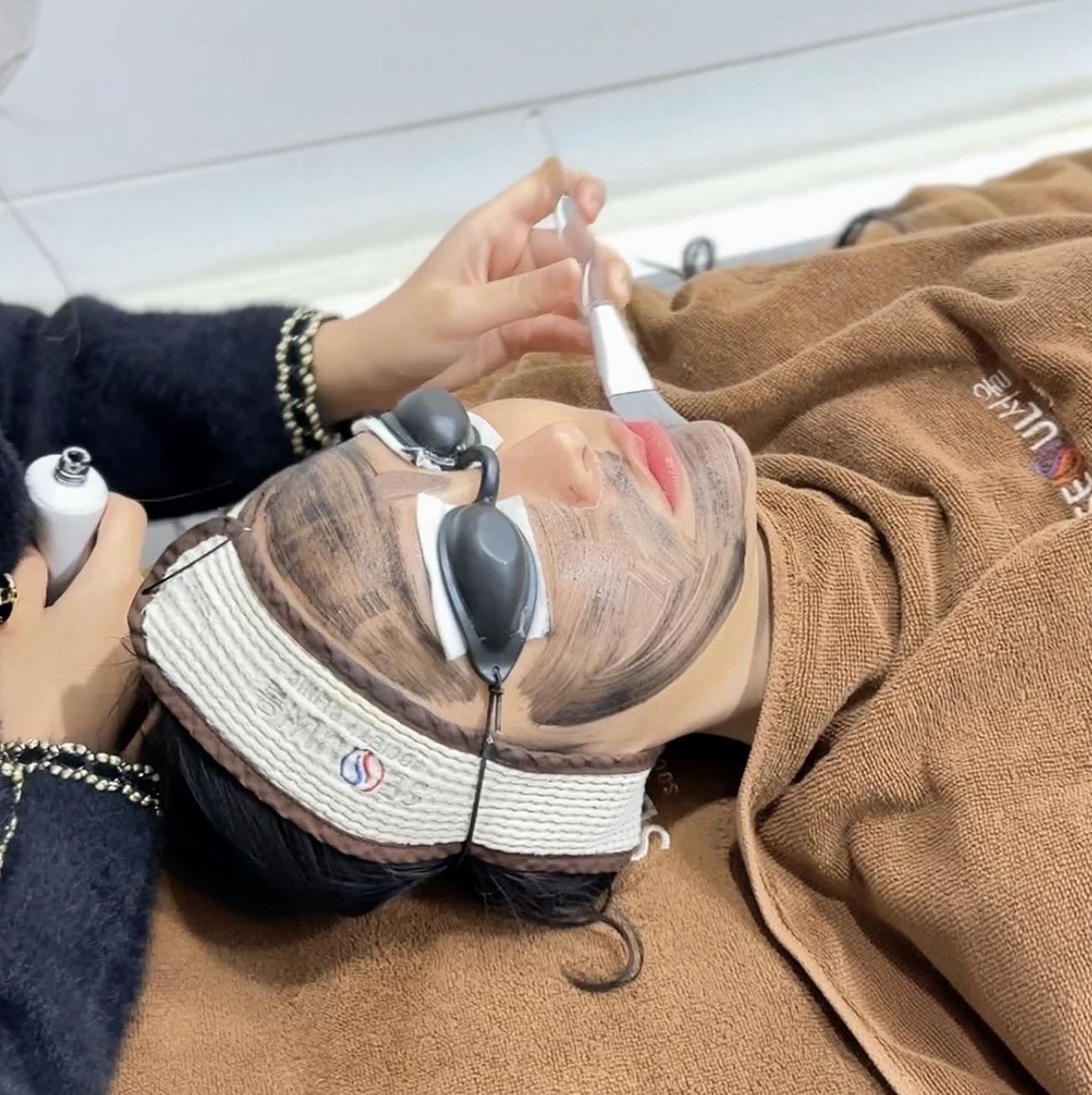 What Should You Avoid After a Carbon Laser Peel?
