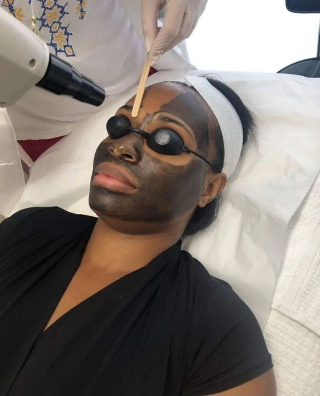 Queen City Project | What Should You Avoid After a Carbon Laser Peel? What happens if you don’t follow the aftercare