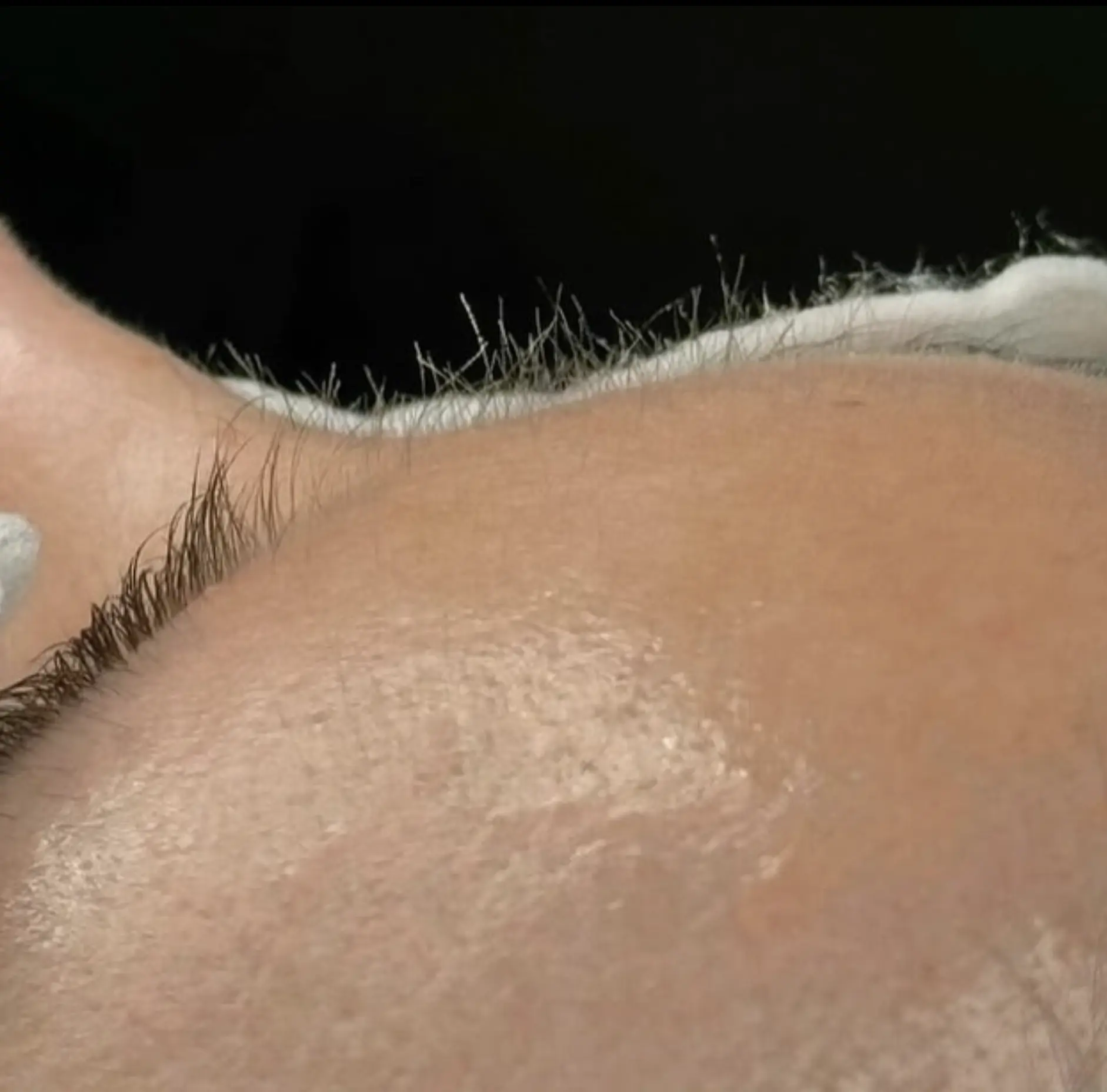Queen City Project | Do and don'ts of dermaplaning? cryotherapy in Brisbane The Facial Hub