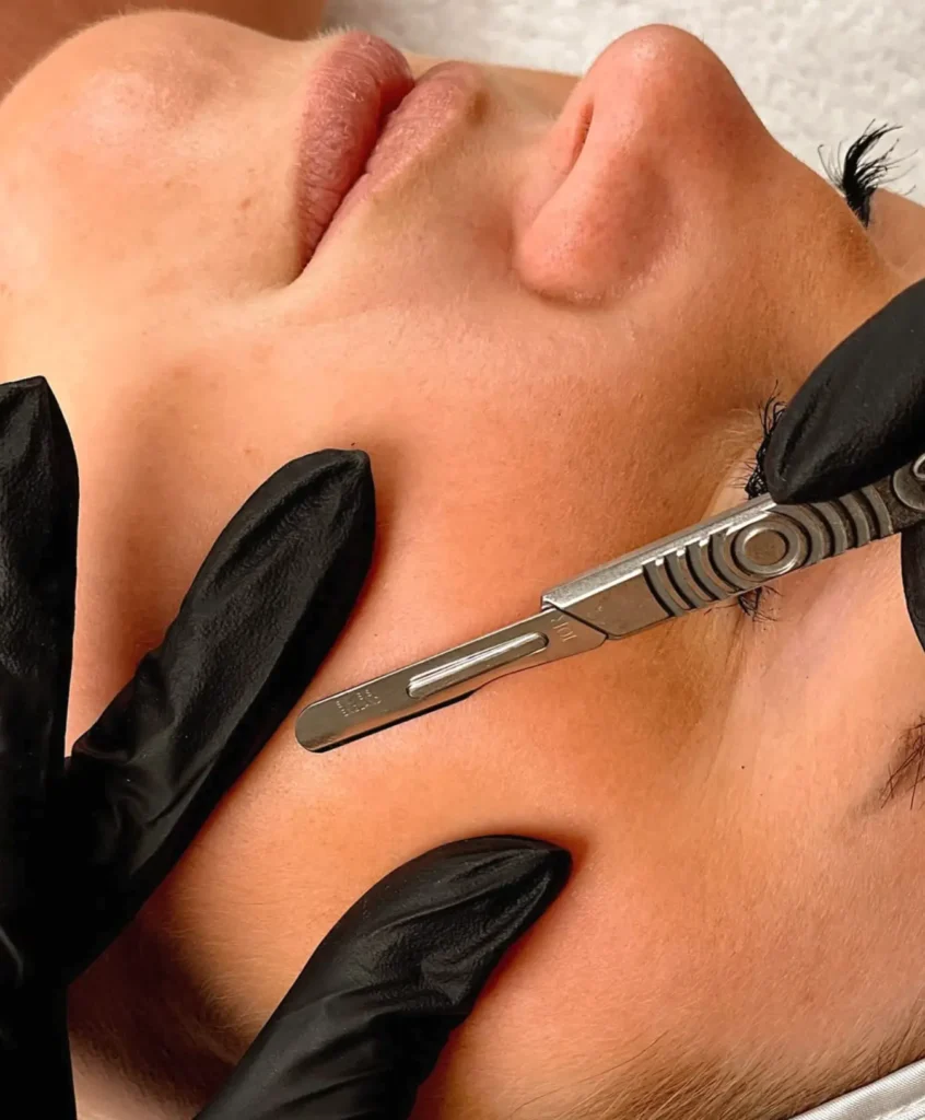 Queen City Project | Do and don'ts of dermaplaning? dermaplaning